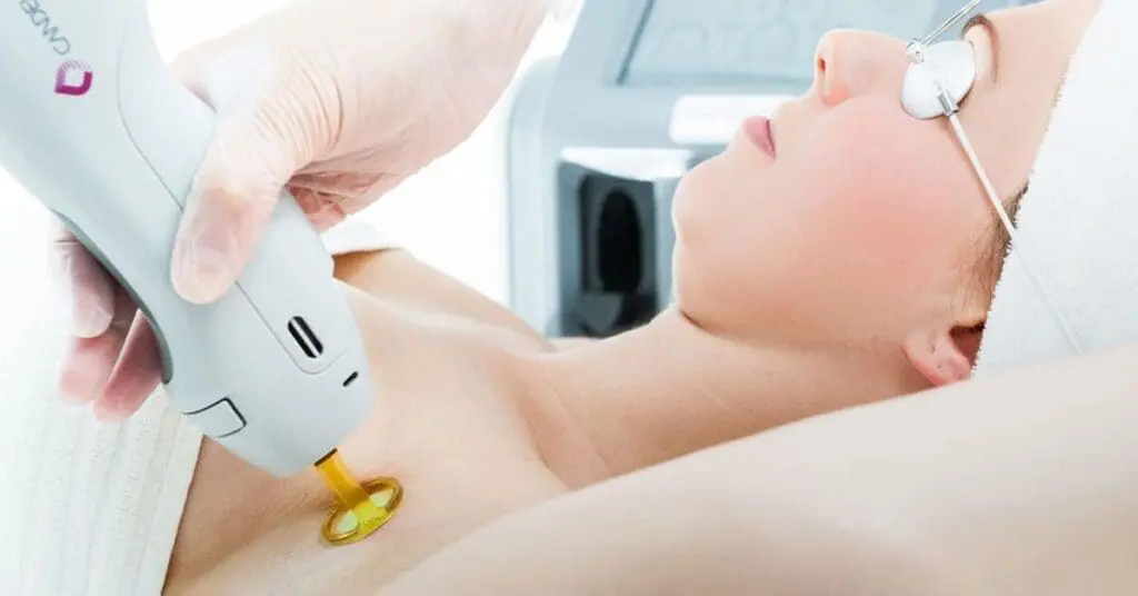 Candela laser hair removal near miami-dade county