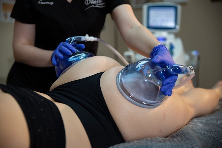 Body Contouring - Vacumm Therapy