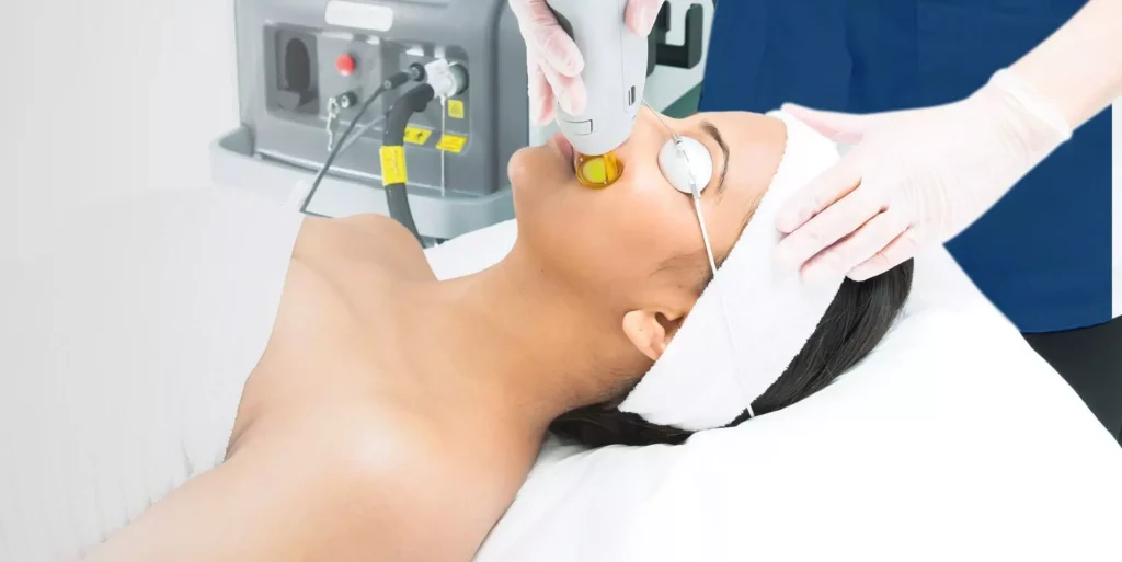 Laser hair removal treatment being performed safely on a patient's face with protective goggles.