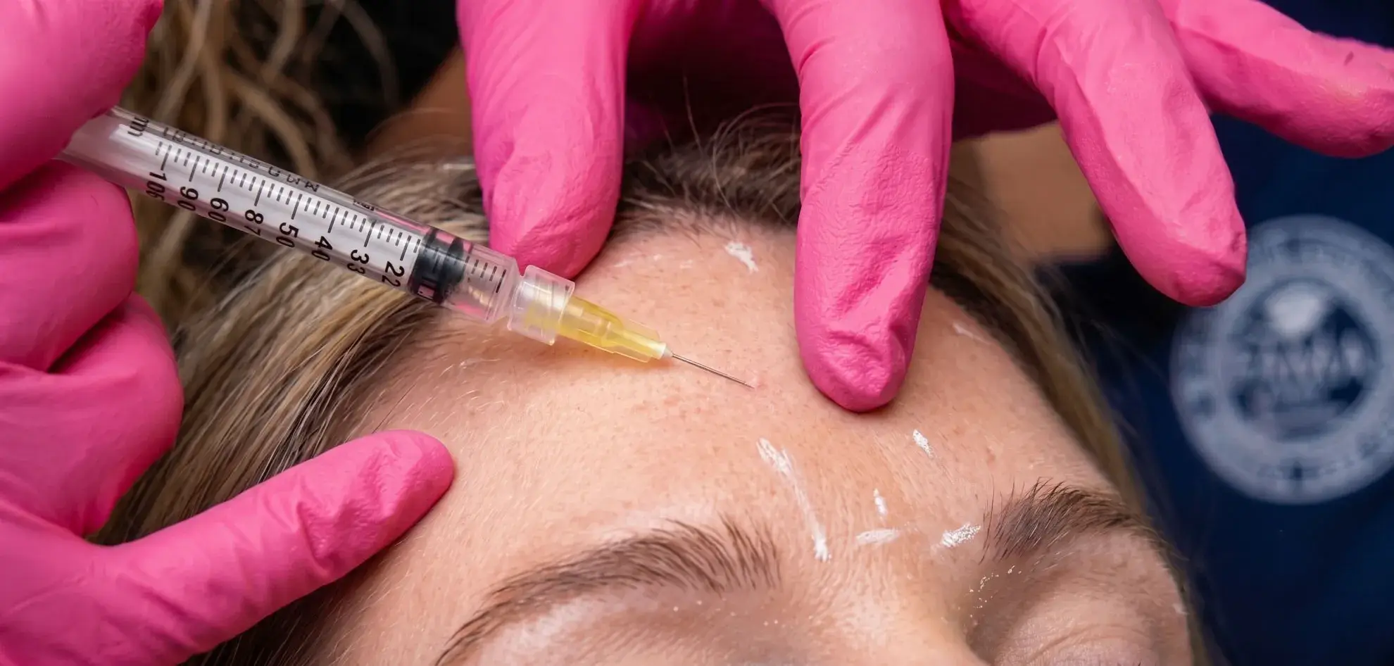 Botulinum toxin clinical training
