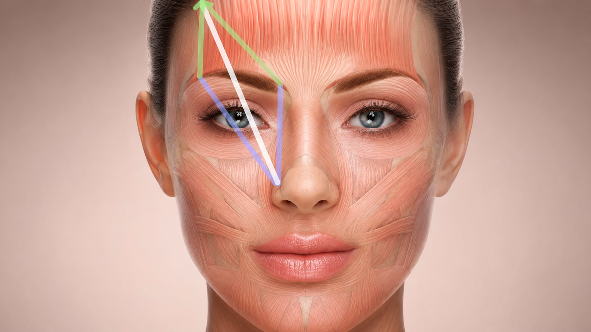 Botox injection technique with facial mapping guidelines over muscle anatomy