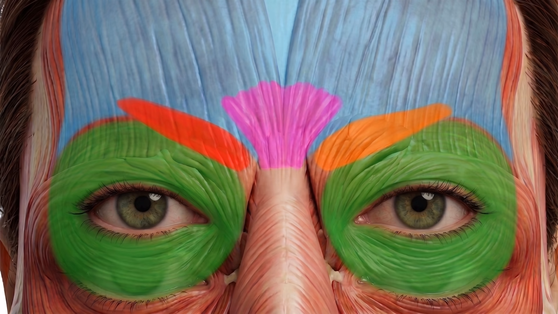 Periorbital and frontalis muscle anatomy with color-coded muscle groups